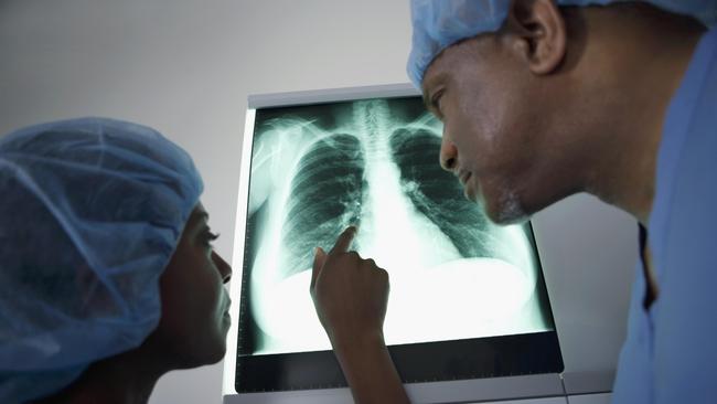 Hari Radiologi Internasional 8 November: Sejarah dan Cara Memperingati