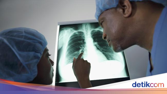 Hari Radiologi Internasional 8 November: Sejarah dan Cara Memperingati