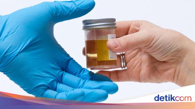 Mahasiswa Pertanyakan Alasan Rencana Tes Urine di Kampus Jakarta