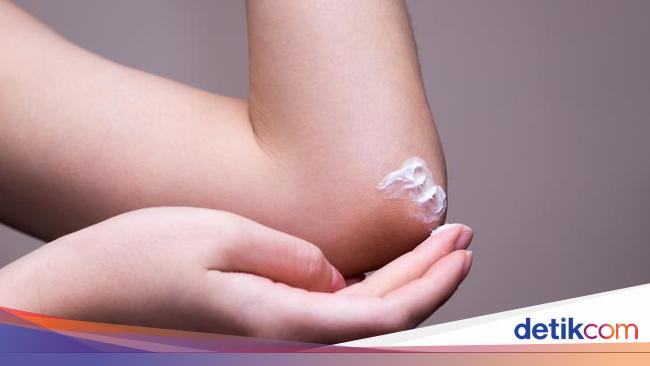 Dok, Adakah Cara Alami Mengatasi Kulit Siku yang Menghitam?