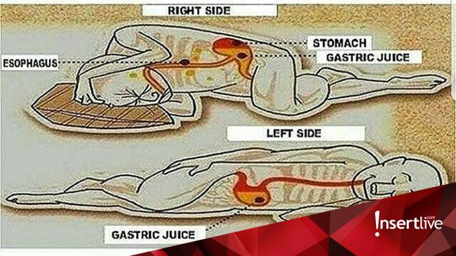 Miring atau Telentang? Ini Posisi Tidur yang Baik untuk Kesehatan Menurut Dokter
