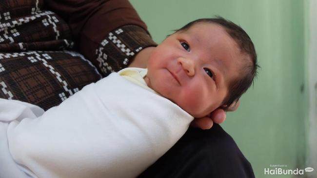 Ada Benjolan Benjolan Kecil Di Belakang Kepala Bayi Apa Itu Ya