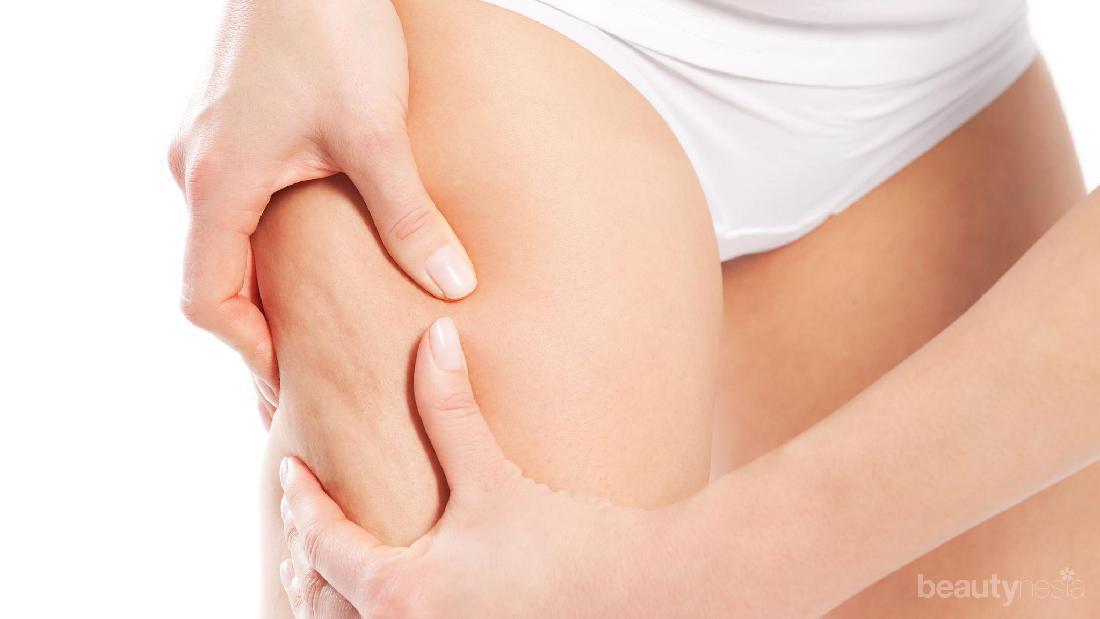 7 Cara Menghilangkan Selulit Dengan Mudah Di Rumah