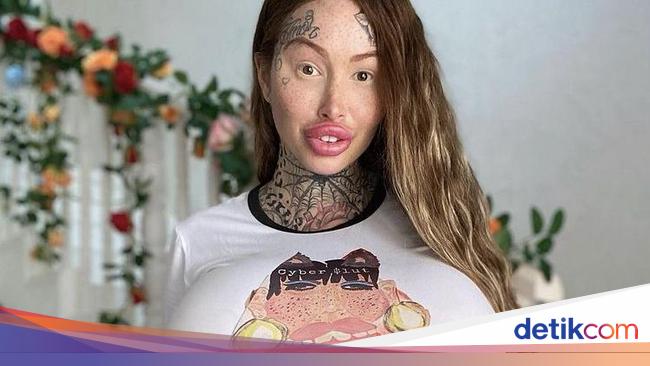 Selebgram Keranjingan Oplas, Organ Intim hingga Hidung Barbie