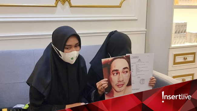 Istri Putra Siregar Sebut Fero Walandouw And Steffi Zamora Saksi Kasus Sang Suami 8971