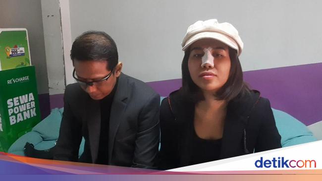 Mayang Dipertanyakan Soal Salat Usai Operasi Hidung, Doddy Sudrajat Beri Respons