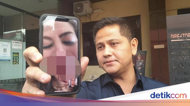 9 Bulan Nikah Sering Alami KDRT, Venna Melinda Diam untuk Tutupi Aib