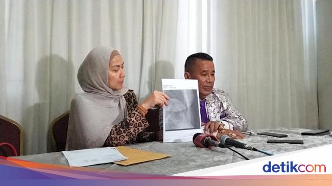 Venna Melinda Tunjukkan Bukti Kuatkan Pengakuan Rusuk Retak Ulah Ferry Irawan