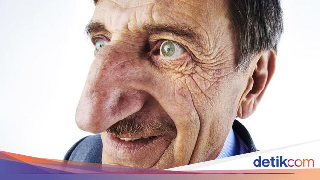 Potret Orang dengan Ciri Fisik Luar Biasa Bikin Kaget Tak Percaya