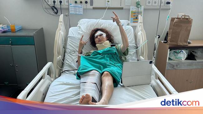 Angela Lee Kecelakaan Mobil, Luka di Wajah hingga Kaki Dipasang Pen