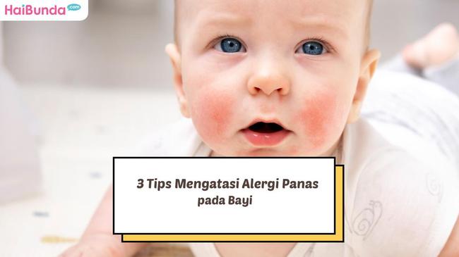 3 Tips Mengatasi Alergi Panas Pada Bayi