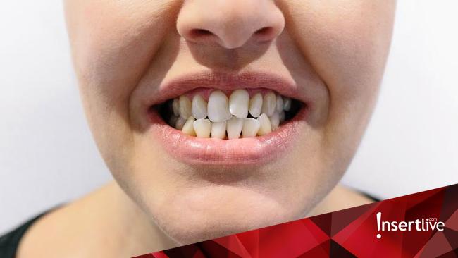 Arti Mimpi Gigi Bawah Copot Menurut Primbon Jawa