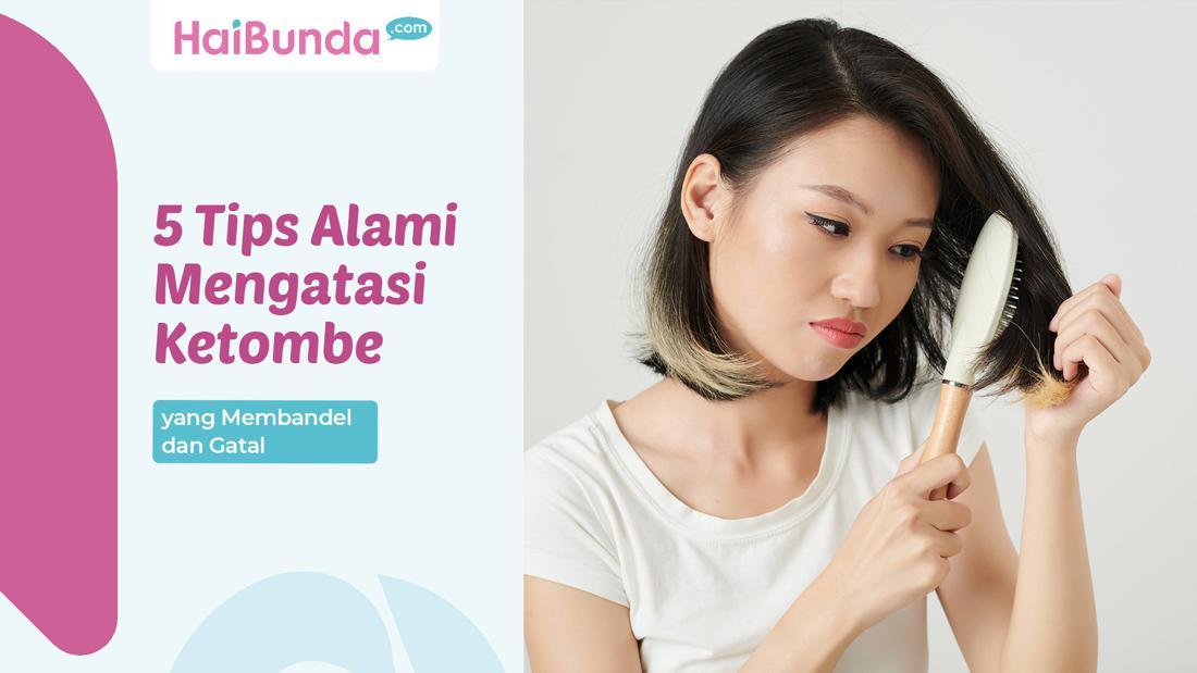 5 Tips Alami Mengatasi Ketombe Yang Membandel Dan Gatal