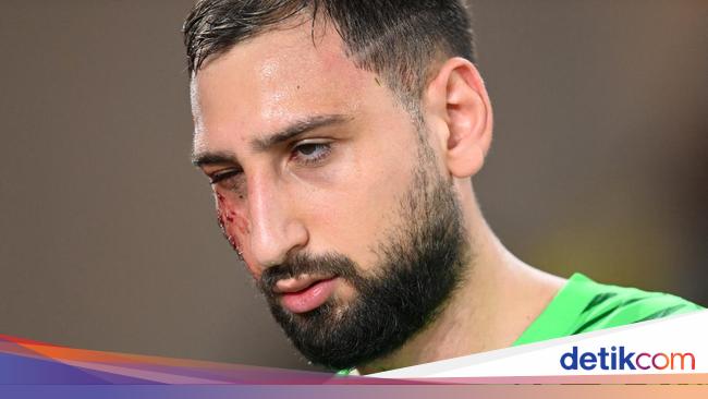 Foto: Detik-detik Wajah Donnarumma Kena Hantam sampai Robek