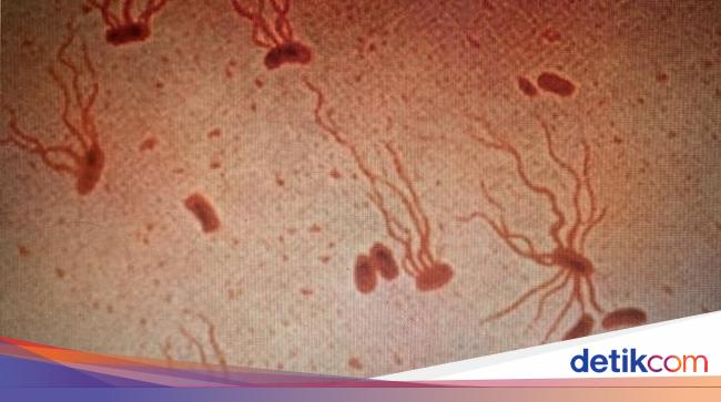 salmonella-typhi-1745476899190_169