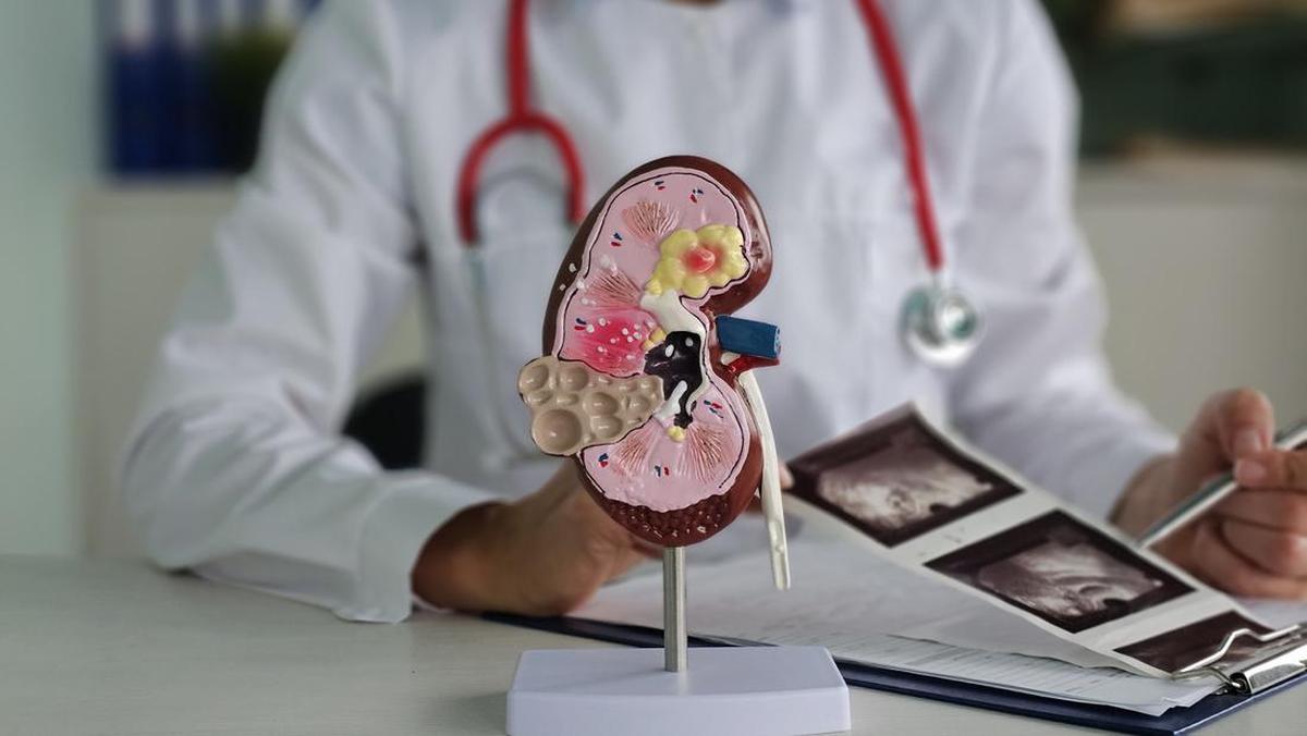 Kasus Gagal Ginjal Ngegas Juga di RI, Makin Banyak Warga +62 Cuci Darah