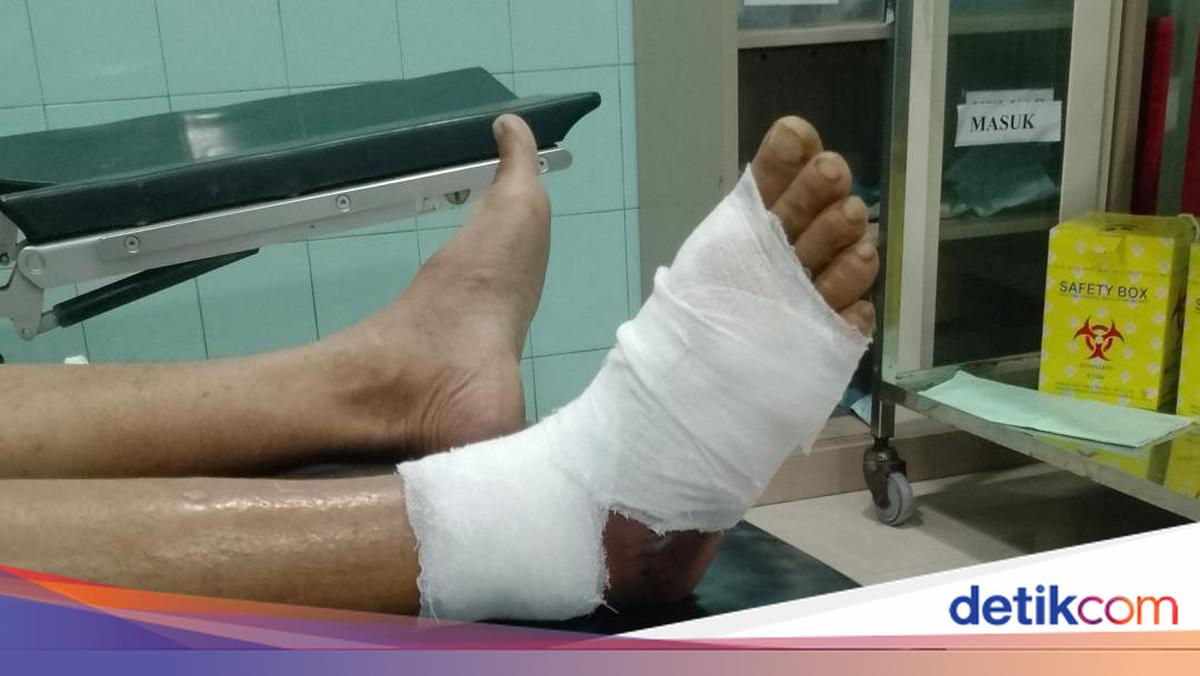 Pria di Brebes Digigit Ular Viper Saat Cari Rumput, Kaki Melepuh