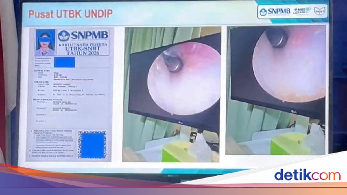 Peserta UTBK Undip Ketahuan Tanam Alat Bantu di Telinga, Diserahkan ke Polsek