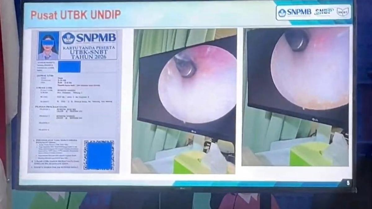 Viral Kecurangan Peserta di UTBK 2026, Kenapa Tetap Culas Meski Berisiko? Ini Kata Psikolog
