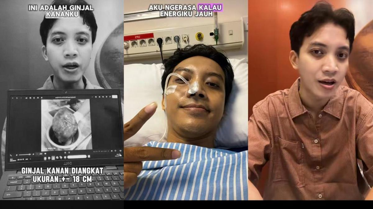 Hidup dengan Satu Ginjal usai Kena Kanker, Pria Surabaya Ini Ungkap Perbedaan di Hidupnya