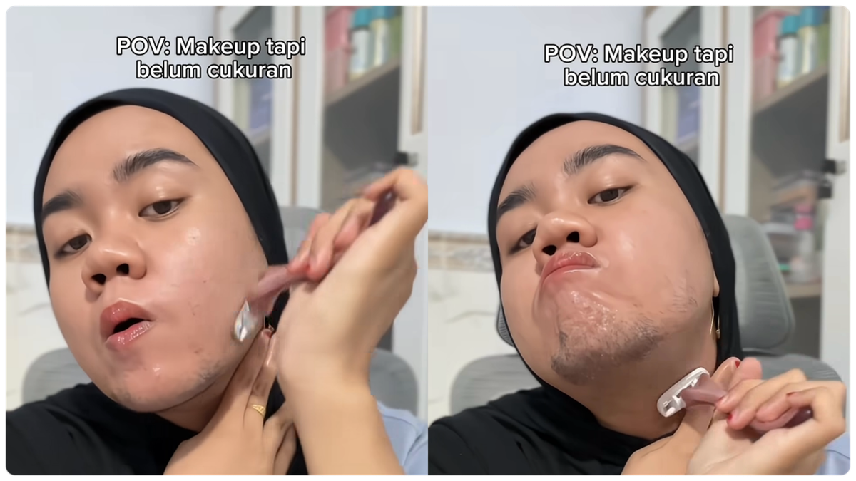 Viral Gadis 23 Tahun Di Madura Tumbuh Brewok, Ternyata Idap Kondisi Ini