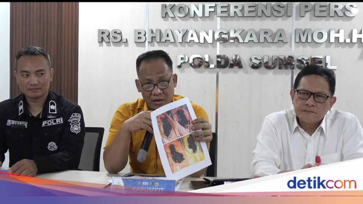 Korban Tewas Kecelakaan Bus ALS di Sumsel Jadi 18 Orang