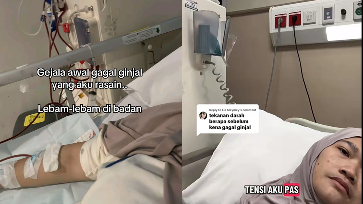 Viral Wanita Bekasi Kena Gagal Ginjal Di Usia Muda, Gejalanya Terlihat Di Wajah