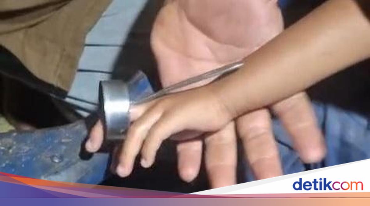Jari Balita di Wonosari Nyangkut Tutup Botol, Ortu Panggil Damkar