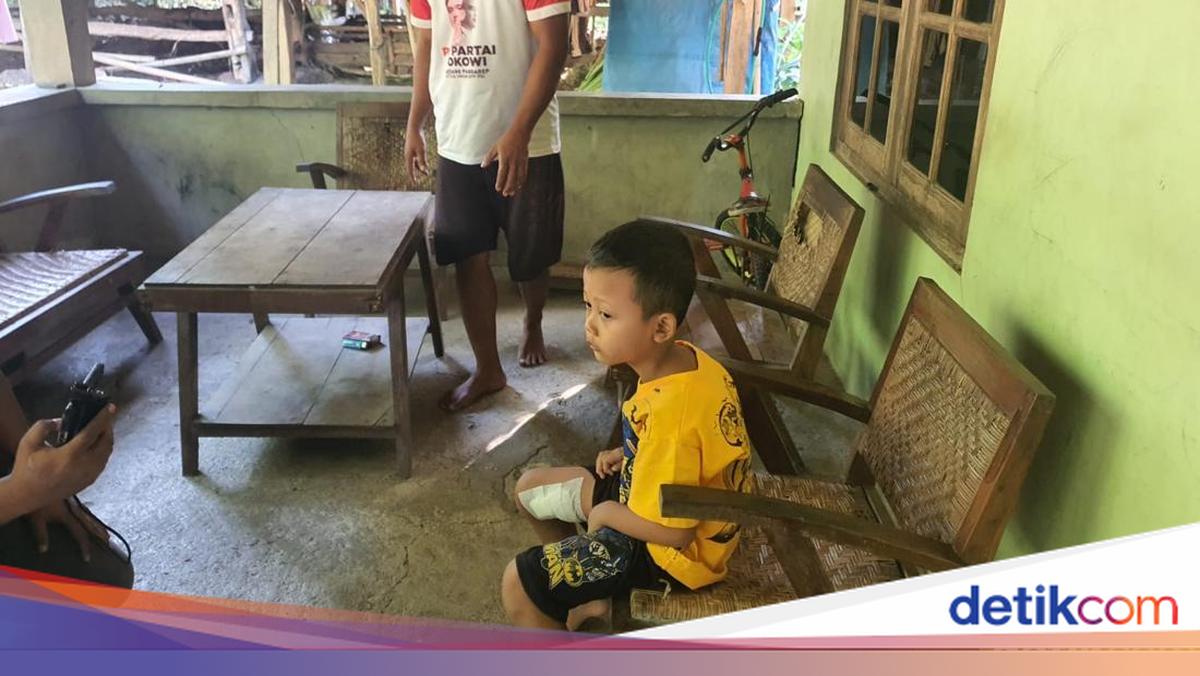 Lepas dari Penangkaran, Beruk Serang 3 Orang di Gunungkidul