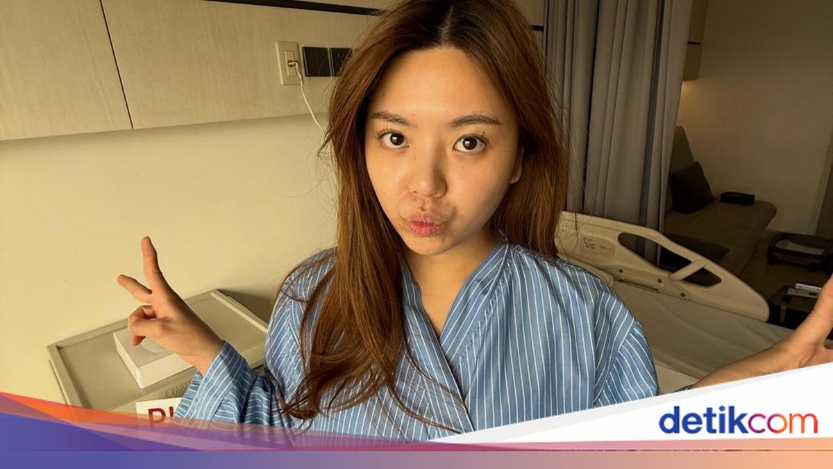 Valencia Nathania Akhirnya Bicara Soal Operasi Jantung