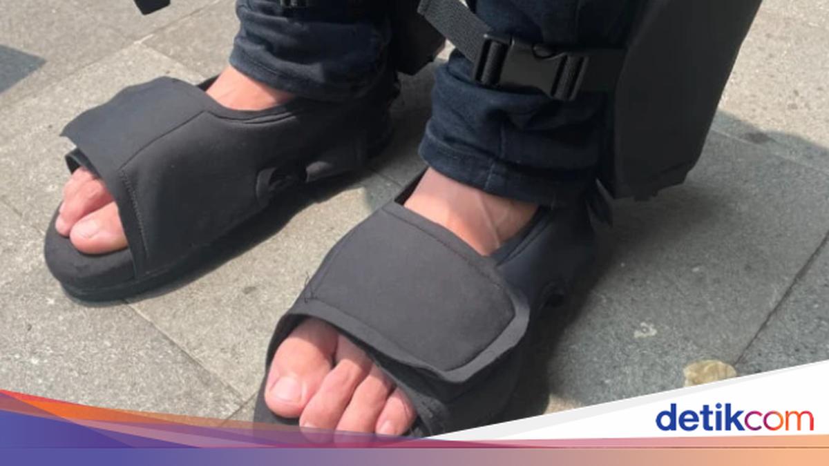 Sandal Bikinan Mahasiswa UGM Ini Bisa Deteksi Komplikasi Diabetes