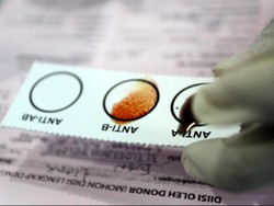 Awas, Pemilik Golongan Darah Ini Lebih Rentan Serangan Jantung