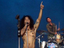 Perhatikan Penampilan-Kaka Transplantasi Rambut, Upaya Slank Tetap Relevan?