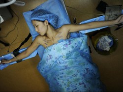 Soal Bentuk Ideal Payudara, Selera Dokter Bedah di Tiap Negara Ternyata Beda