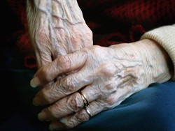 Manusia Bisa Hidup Abadi Asalkan Bisa Tiru Hydra