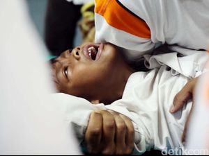 Ragam Drama Sunat Masa Lalu, Diiris Pakai Bambu hingga Ditutupi Tudung Saji Ragam Drama Sunat Masa Lalu, Diiris Pakai Bambu hingga Ditutupi Tudung Saji