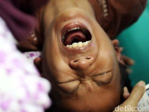 Ngilu! Potongan Kurang Presisi, Pria Ini Harus Jalani Sunat Revisi Ngilu! Potongan Kurang Presisi, Pria Ini Harus Jalani Sunat Revisi
