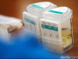 Pegawai Pemkab Jembrana Bakal Tes Narkoba Buntut 2 Orang Diciduk Polisi