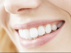 Ingin Memutihkan Gigi? Ini yang Harus Anda Perhatikan