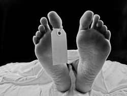 Gara-gara Botol Sampo Masuk ke Anus, Wanita Ini Meninggal