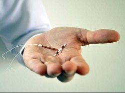 Kiat Sragen Turunkan Kelahiran: Sosialisasi KB yang Masif