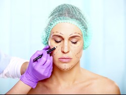 Saran Dokter Tompi untuk Wanita yang Ingin Operasi Plastik di Wajah