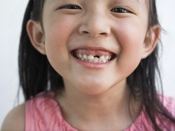 Batasi Konsumsi Minuman dan Makanan Manis Agar Gigi Anak Tak Gampang Busuk