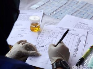 10 Warna Urine dan Artinya Bagi Kondisi Kesehatan (2)