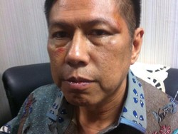 6 Bulan Dilaporkan ke Polda Metro, Apa Kabar Kasus Pemukulan Anggota DPR?