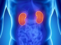 Indonesia Beriklim Tropis, Masyarakat Berisiko Tinggi Terserang Batu Ginjal