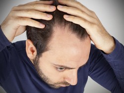 Aneh, Pria Ini Bolak-balik Pingsan Gara-gara Obat Pencegah Rontok