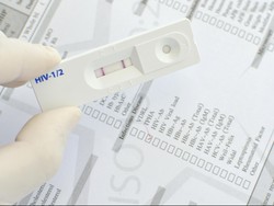 Stigma Bisa Hambat Kesadaran Pentingnya Tes HIV