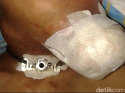 Kanker Laring Cukup Ganas, ini Indikasi yang Patut Diwaspadai