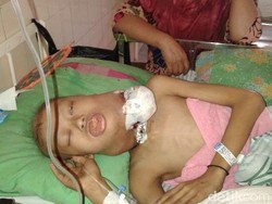 Saat Kritis, Bocah Penderita Kanker Laring ini Ditumpangkan Bus ke Rumah Sakit